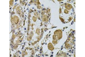 Immunohistochemistry of paraffin-embedded Human stomach using Cyclin A2 Polyclonal Antibody at dilution of 1:100 (40x lens). (Cyclin A 抗体)