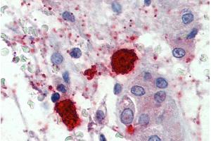 ABIN768626 (1. (CMA1 抗体  (Internal Region))