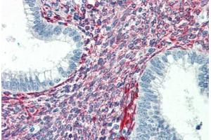 Human Uterus (formalin-fixed, paraffin-embedded) stained with SERPINH1 antibody ABIN364502 at 5 ug/ml followed by biotinylated anti-mouse IgG secondary antibody ABIN481714, alkaline phosphatase-streptavidin and chromogen. (SERPINH1 抗体)