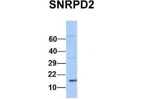 Host:  Rabbit  Target Name:  SNRPD2  Sample Type:  Human 293T  Antibody Dilution:  1. (SNRPD2 抗体  (Middle Region))