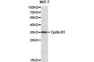 Western blot analysis of MCF-7 cell lysate ,using Cyclin D1 antibody. (Cyclin D1 抗体)