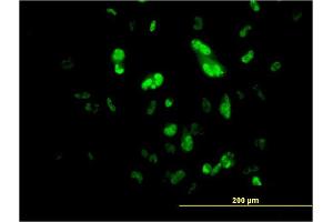 Immunofluorescence of monoclonal antibody to FOXA2 on HepG2 cell. (FOXA2 抗体  (AA 363-457))