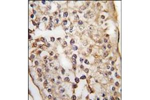 Formalin-fixed and paraffin-embedded human testis tissue reacted with PUM1 Antibody (C-term), which was peroxidase-conjugated to the secondary antibody, followed by DAB staining. (PUM1 抗体  (N-Term))