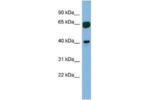 WB Suggested Anti-RAB3IL1 Antibody Titration: 0. (RAB3IL1 抗体  (Middle Region))