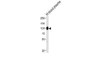 Western blot analysis of lysate from human blood plasma tissue lysate, using PLG Antibody at 1:1000 at each lane. (PLG 抗体  (N-Term))