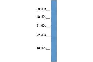 WB Suggested Anti-Hspb7  Antibody Titration: 0. (HSPB7 抗体  (C-Term))