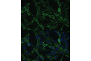 Immunofluorescence analysis of NIH-3T3 cells using CALU antibody (ABIN6129533, ABIN6137878, ABIN6137880 and ABIN6222201) at dilution of 1:100. (CALU 抗体  (AA 20-315))