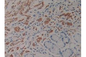 Detection of NT-ProANP in Human Stomach Tissue using Polyclonal Antibody to N-Terminal Pro-Atrial Natriuretic Peptide (NT-ProANP) (PRO-ANP 抗体  (AA 25-123))