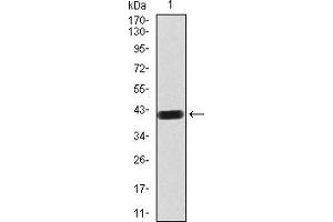 Western Blotting (WB) image for anti-Low Density Lipoprotein Receptor-Related Protein 1 (LRP1) (AA 20-155) antibody (ABIN5897030) (LRP1 抗体  (AA 20-155))