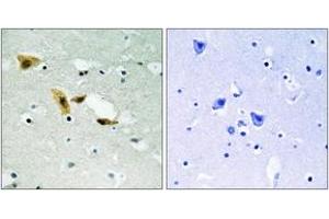 Immunohistochemistry analysis of paraffin-embedded human brain tissue, using APLF (Ab-116) Antibody.