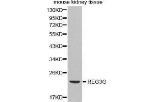 Western Blotting (WB) image for anti-Regenerating Islet Derived Protein 3 gamma (REG3g) antibody (ABIN3023038) (REG3g 抗体)
