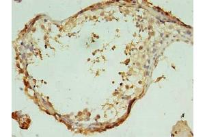 Immunohistochemistry of paraffin-embedded human testis tissue using ABIN7171818 at dilution of 1:100 (Testis-Expressed Protein 47 (TEX47) (AA 1-253) 抗体)