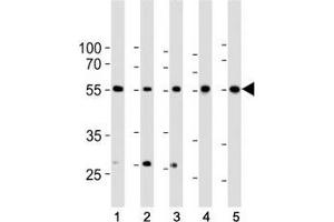Western blot analysis of lysate from 1) HeLa, 2) K562, 3) MCF-7 cell line, 4) human liver and 5) mouse liver tissue lysate using BMPR1A antibody at 1:1000. (BMPR1A 抗体  (AA 1-30))