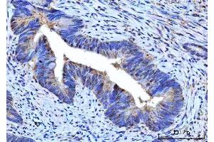 IHC analysis of RPS5 using anti-RPS5 antibody (ABIN7599076).