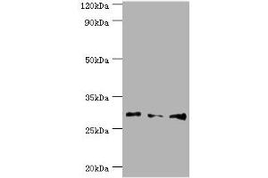Western blot All lanes: Homeobox protein Hox-B5 antibody at 8 μg/mL Lane 1: HepG2 whole cell lysate Lane 2: Rat liver tissue Lane 3: Rat lung tissue Secondary Goat polyclonal to rabbit IgG at 1/10000 dilution Predicted band size: 29 kDa Observed band size: 29 kDa (HOXB5 抗体  (AA 1-170))