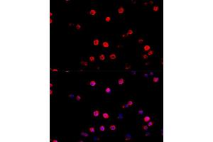 Immunofluorescence analysis of R. (PD-L1 抗体  (AA 19-238))