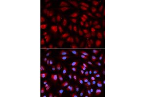 Immunofluorescence analysis of U2OS cells using PLK1 antibody. (PLK1 抗体)