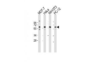 Western Blot at 1:2000 dilution Lane 1: MCF-7 whole cell lysates Lane 2: Hela whole cell lysates Lane 3: NIH/3T3 whole cell lysates Lane 4: PC-12 whole cell lysates Lysates/proteins at 20 ug per lane. (Pyruvate Kinase 抗体  (N-Term))