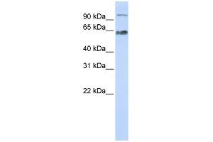 WB Suggested Anti-KIAA0892 Antibody Titration: 0. (MAU2/KIAA0892 抗体  (Middle Region))