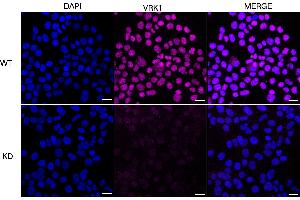 anti-Vaccinia Related Kinase 1 (VRK1) antibody