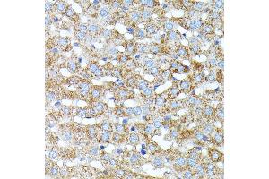 Immunohistochemistry of paraffin-embedded rat liver using Haptoglobin (Haptoglobin (HP)) antibody (ABIN3022157, ABIN3022158, ABIN1513029, ABIN1514188 and ABIN6218636) at dilution of 1:100 (40x lens). (Haptoglobin 抗体)