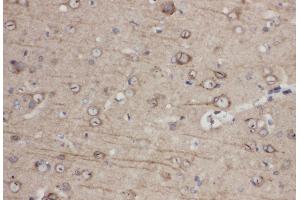 Anti-Eph receptor A1 antibody, IHC(P) IHC(P): Rat Brain Tissue (EPHA1 抗体  (C-Term))