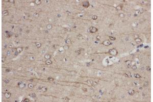 Anti-Eph receptor A1 antibody, IHC(P) IHC(P): Rat Brain Tissue