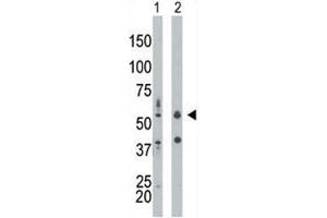 PKR antibody used in western blot to detect PRKR/PKR in mouse liver tissue lysate (Lane 1) and HepG2 cell lysate (2). (EIF2AK2 抗体  (AA 11-42))