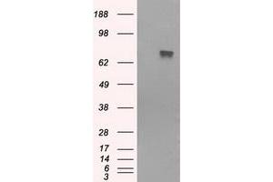 Western Blotting (WB) image for anti-Bruton Agammaglobulinemia tyrosine Kinase (BTK) antibody (ABIN1496971) (BTK 抗体)