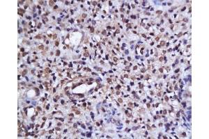 Formalin-fixed and paraffin embedded human endometrium tissue labeled with Anti-phospho-AKT/PKB(Ser473) Polyclonal Antibody, Unconjugated  at 1:200, followed by conjugation to the secondary antibody and DAB staining (AKT 1/2/3 抗体  (pSer473))