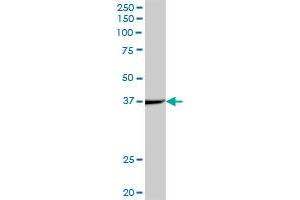 Western Blotting (WB) image for anti-Acyl-CoA Dehydrogenase, C-2 To C-3 Short Chain (Acads) (AA 1-412) antibody (ABIN513054)