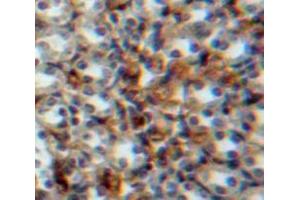 Used in DAB staining on fromalin fixed paraffin-embedded Kidney tissue (Vitamin D-Binding Protein 抗体  (AA 17-476))