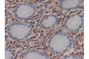Detection of MEAI in Human Stomach Tissue using Polyclonal Antibody to Menin (MEAI) (Menin 抗体  (AA 219-395))