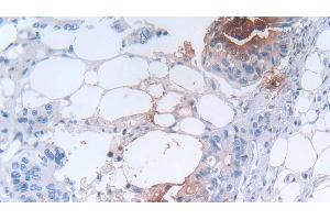Immunohistochemistry (IHC) image for anti-Defensin, alpha 3, Neutrophil-Specific (DEFa3) (AA 21-94) antibody (ABIN7439243)