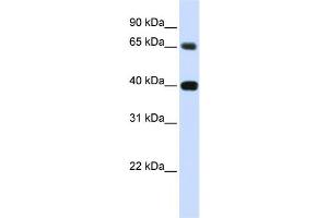 Western Blotting (WB) image for anti-Thymopoietin (TMPO) antibody (ABIN2458894) (Thymopoietin 抗体)