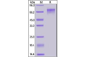 Cynomolgus GUCY2C, His Tag on  under reducing (R) condition.