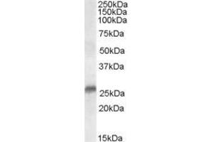 Western Blotting (WB) image for anti-Steroid-5-alpha-Reductase, alpha Polypeptide 2 (3-Oxo-5 alpha-Steroid delta 4-Dehydrogenase alpha 2) (SRD5A2) (N-Term) antibody (ABIN185347)