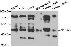 Western blot analysis of extracts of various cell lines, using ZBTB25 antibody. (ZBTB25 抗体)