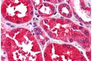 Immunohistochemistry (IHC) image for anti-Aldo-Keto Reductase Family 1, Member B1 (Aldose Reductase) (AKR1B1) antibody (ABIN5912019) (AKR1B1 抗体)