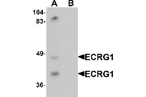 Western blot analysis of ECRG1 in mouse liver tissue lysate with ECRG1 antibody at 1 µg/mL in (A) the absence and (B) the presence of blocking peptide. (TMPRSS11A 抗体  (C-Term))
