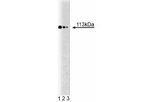 Western blot analysis of Stat2 on a K-562 cell lysate (Human bone marrow myelogenous leukemia, ATCC CCL-243). (STAT2 抗体  (AA 1-178))