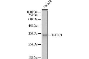 Western blot analysis of extracts of HepG2 cells, using IGFBP1 antibody (ABIN3023444, ABIN3023445, ABIN3023446 and ABIN6219959) at 1:1000 dilution. (IGFBPI 抗体  (AA 26-259))