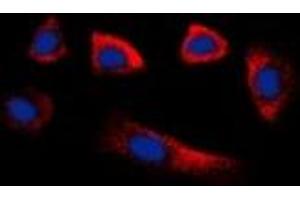 Immunofluorescent analysis of Glycerate Kinase staining in HepG2 cells.