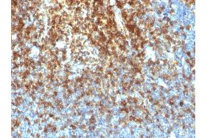 Formalin-fixed, paraffin-embedded human Tonsil stained with CD43 Rabbit Recombinant Monoclonal Antibody (SPN/1766R). (Recombinant CD43 抗体)