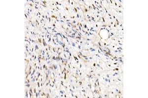 Immunohistochemistry (IHC) image for anti-SWI/SNF Related, Matrix Associated, Actin Dependent Regulator of Chromatin, Subfamily B, Member 1 (SMARCB1) (AA 77-376) antibody (ABIN6148107)