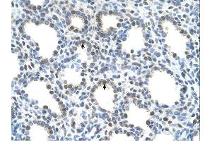 Immunohistochemistry (IHC) image for anti-Solute Carrier Family 15 (H+/Peptide Transporter), Member 4 (SLC15A4) (N-Term) antibody (ABIN635119)