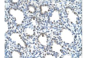 SLC15A4 antibody was used for immunohistochemistry at a concentration of 4-8 ug/ml. (SLC15A4 抗体  (N-Term))