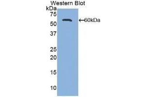 Detection of Recombinant ALCAM, Mouse using Polyclonal Antibody to Activated Leukocyte Cell Adhesion Molecule (ALCAM) (CD166 抗体  (AA 28-527))