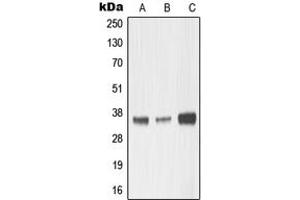 Western blot analysis of MMP23 expression in HepG2 (A), mouse kidney (B), rat kidney (C) whole cell lysates. (Matrix Metallopeptidase 23 (MMP23) (Center) 抗体)