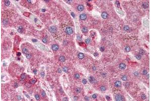 Liver: Formalin-Fixed, Paraffin-Embedded (FFPE) (HYAL1 抗体  (AA 325-339))